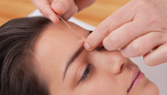 Acutherapy Acupuntura Alicante thumb 6